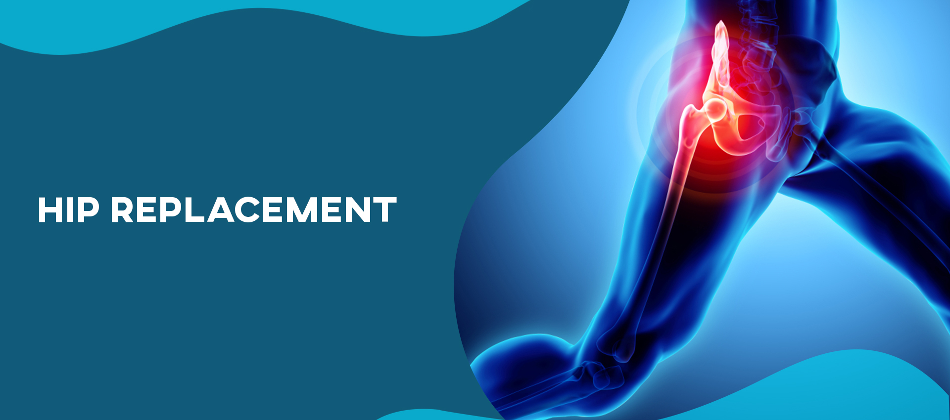 Hip Replacement Doctor In Jaipur